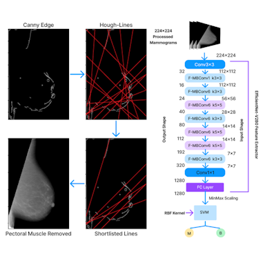 A Hybrid Approach to Mammography Image Processing and Cancerous Lesion Classification
